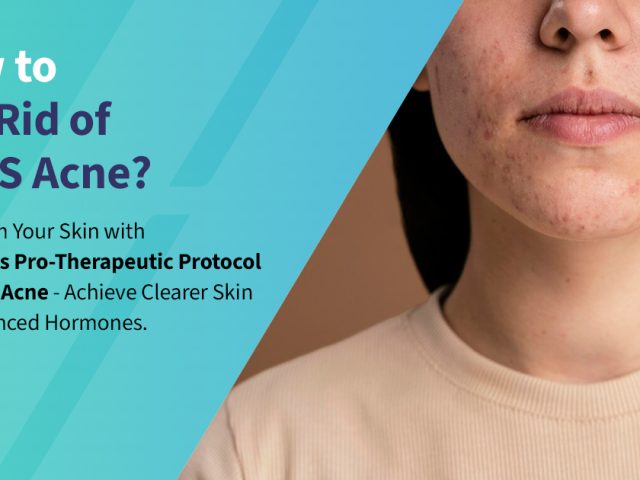 How to Get Rid of PCOS Acne?