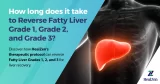 How Long Does It Take to Reverse Fatty Liver Grade 1, Grade 2, and Grade 3