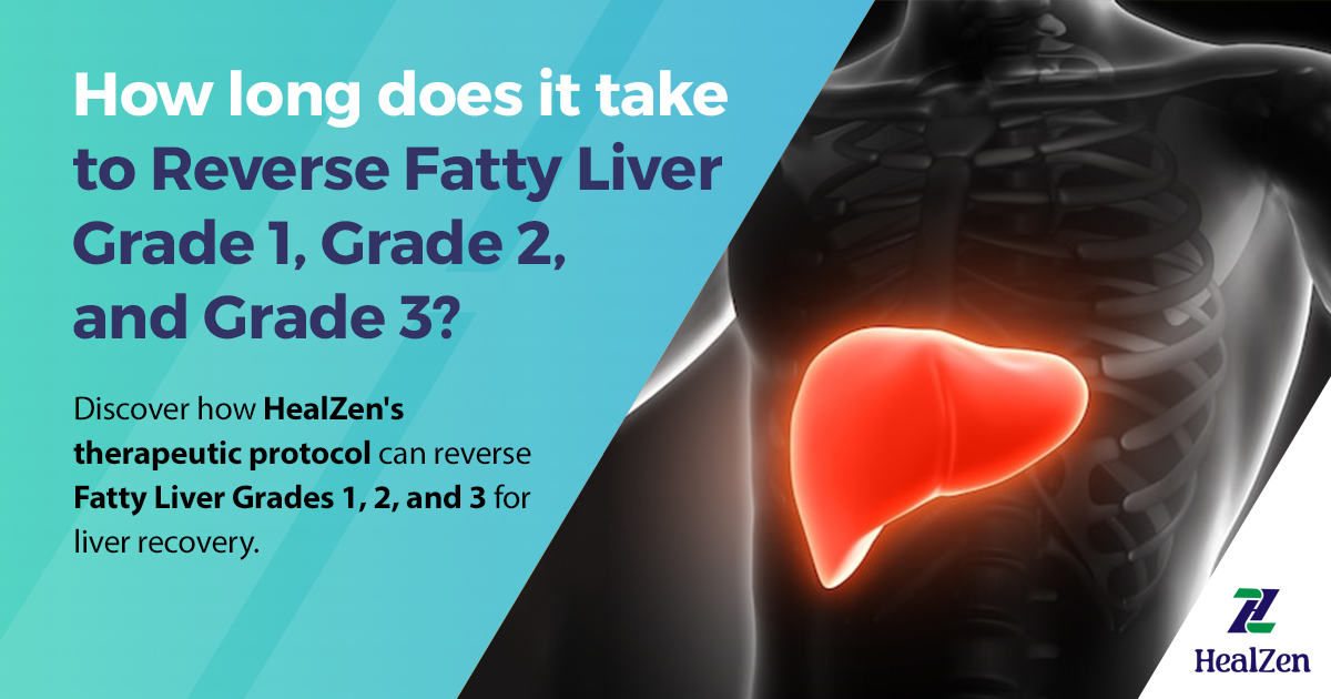 How Long Does It Take to Reverse Fatty Liver Grade 1, Grade 2 and Grade 3?